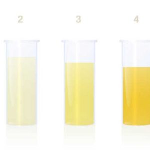 tableau des couleurs de l'urine d'une chien